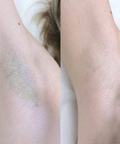 -5438263019147300968_120